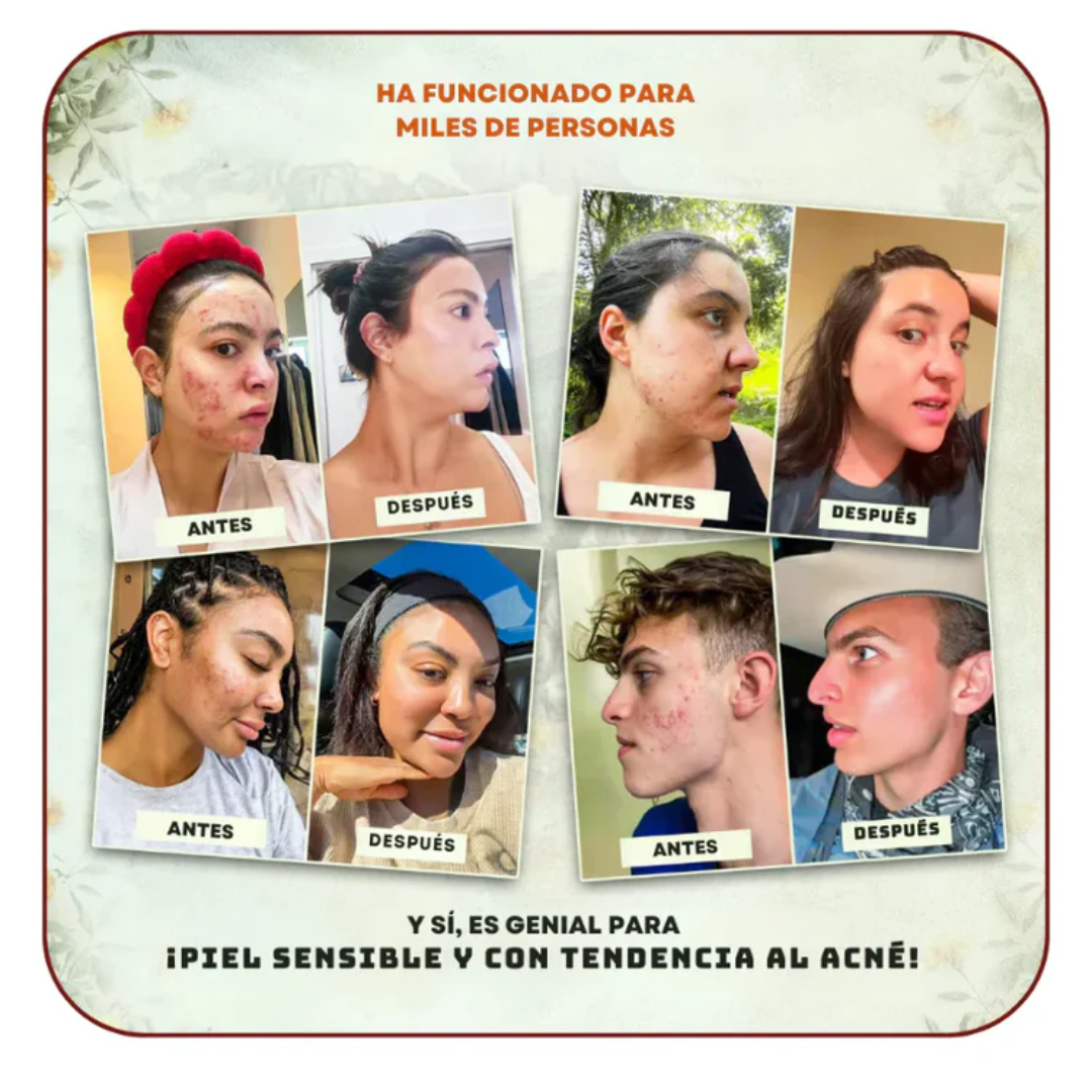 Crema Hidratante Facial Evil Goods™ - Bálsamo Natural de Sebo y Miel