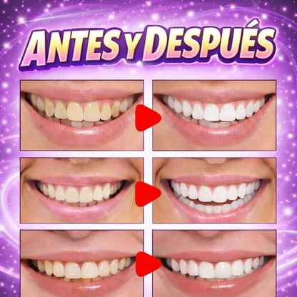 Yasenshi® Blanqueador Dental: ¡El Secreto Púrpura para una Sonrisa Más Blanca!