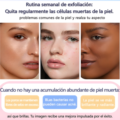 QUARXERY Gel Exfoliante Facial con Nicotinamida – Limpieza Profunda sin Irritar la Piel