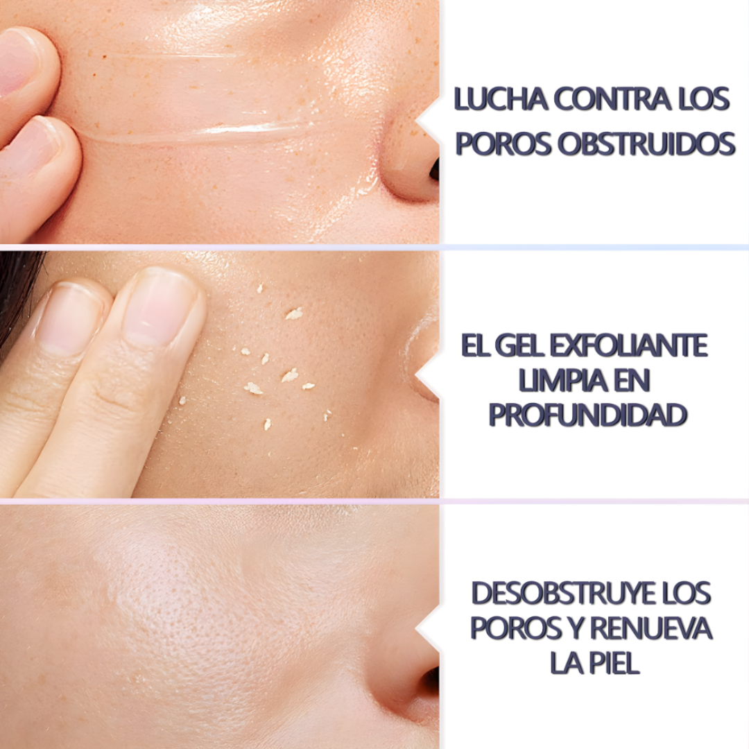 QUARXERY Gel Exfoliante Facial con Nicotinamida – Limpieza Profunda sin Irritar la Piel