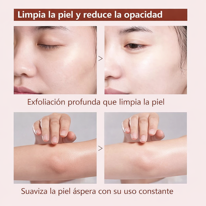 QUARXERY Gel Exfoliante Facial con Nicotinamida – Limpieza Profunda sin Irritar la Piel