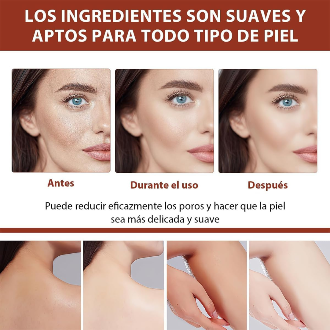QUARXERY Gel Exfoliante Facial con Nicotinamida – Limpieza Profunda sin Irritar la Piel